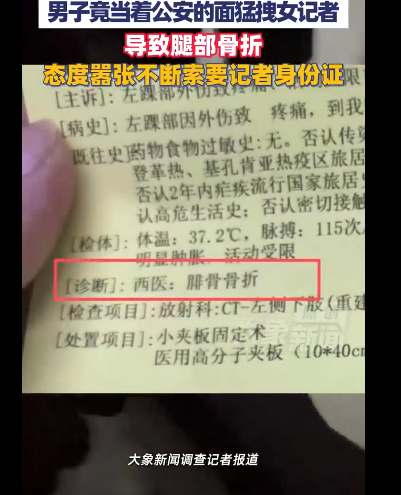 女记者暗访代孕窝点遭拖拽致骨折，中国记协发声 - 图3