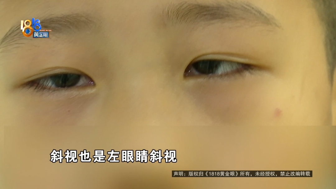 775度、300度，左右镜片装反，孩子戴了一年？大光明眼镜：不可能有失误 - 图2