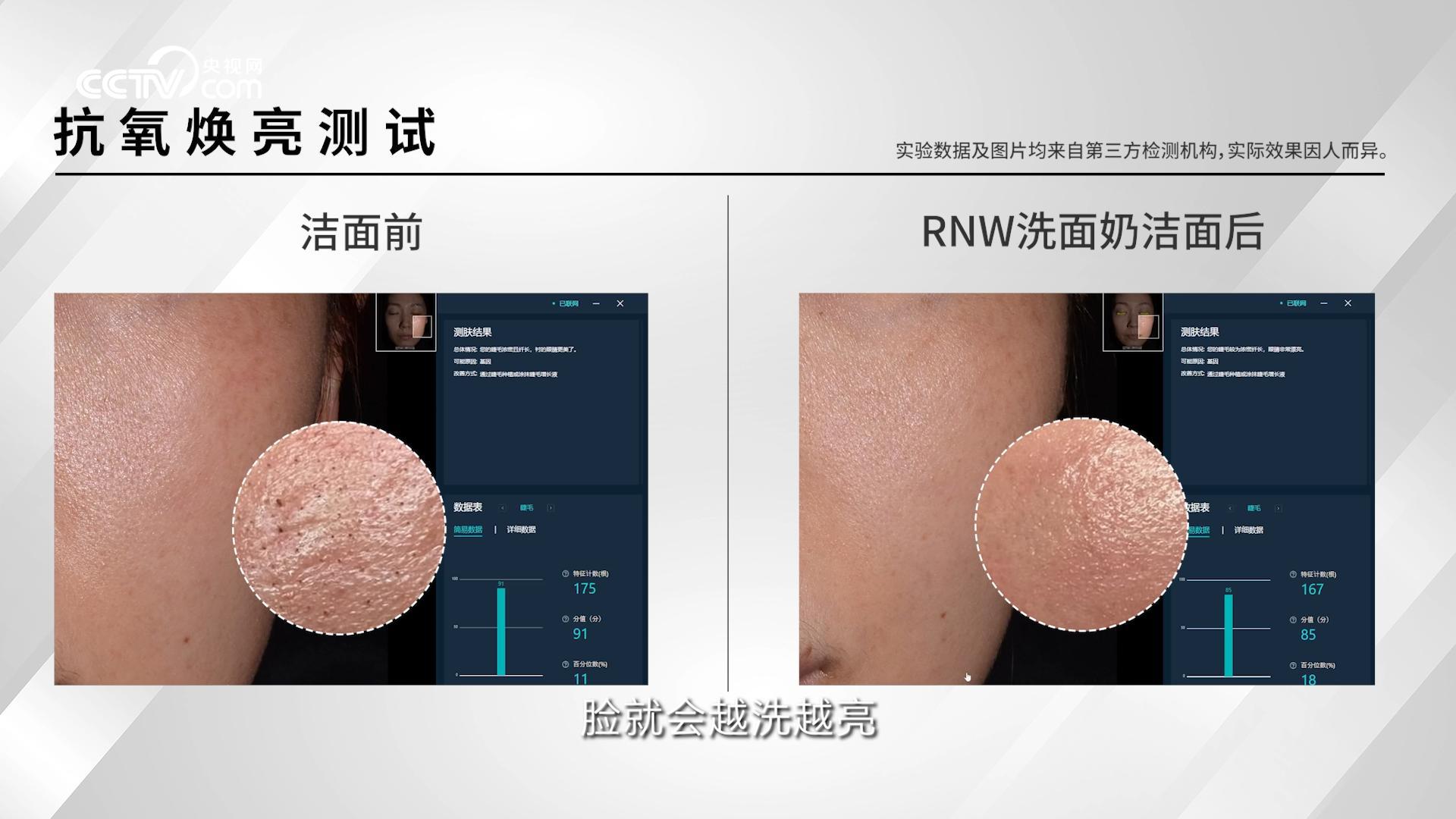 RNW如薇联合央视网发布洁面科普短片，以科技赋能大众科学护肤 - 图3