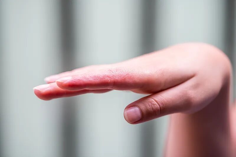 近期高发！这种手上爱长的小水疱，到底是什么？附止痒攻略→ - 图1