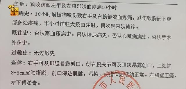 女子被大狼狗扑咬血肉模糊 警方介入 - 图4