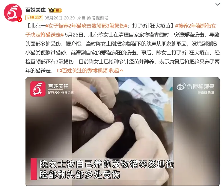 惨不忍睹！女子被自家养了2年的猫疯狂攻击，颅部3级损伤 - 图4