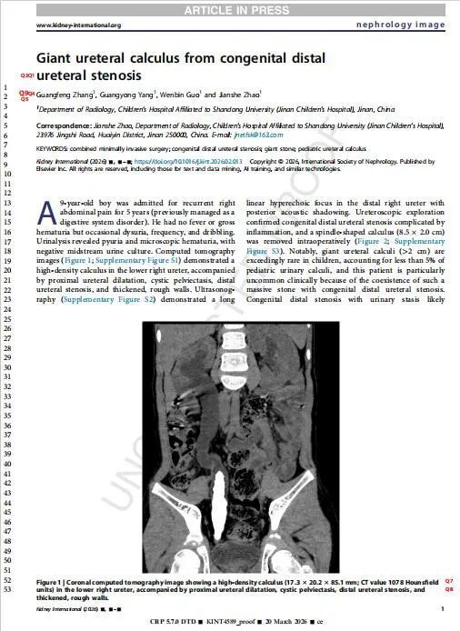 山东大学附属儿童医院医学影像科病例报道在国际权威期刊《Kidney International》发表 - 图1