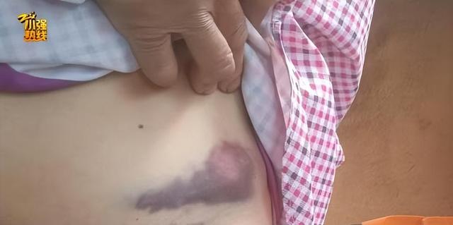 女子被大狼狗扑咬血肉模糊 警方介入 - 图2