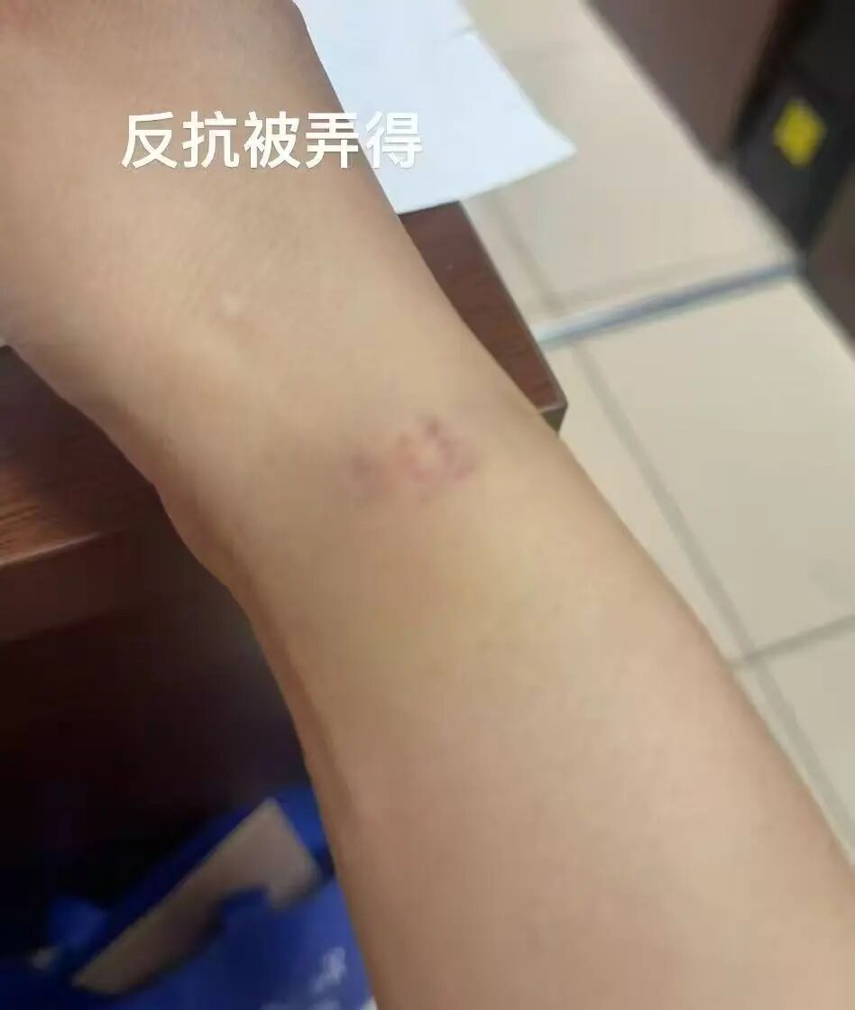 女子称车祸住院遭男医生侵犯，送检拭子中检出该医生DNA，警方调查后未立案 - 图3